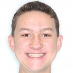 Matt