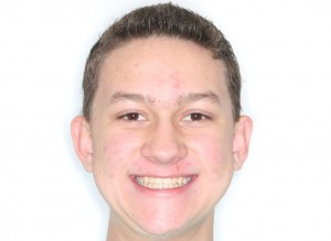 Matt
