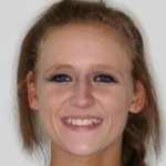Kelsey